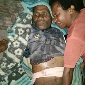 Dogiyai Berduka: Warga Sipil Kembali Jadi Korban Penembakan Aparat di Moanemani